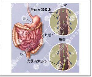 引起大便困难的原因有哪些